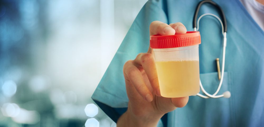 Urine Test May Soon Be Able to Predict Likelihood of Cervical Cancer