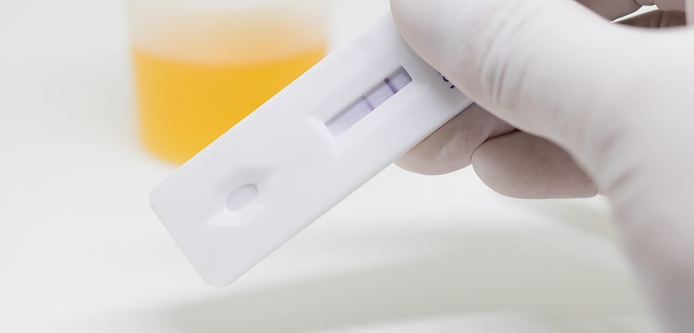 Strips Similar to Home Pregnancy Tests Would Detect Cervical Cancer