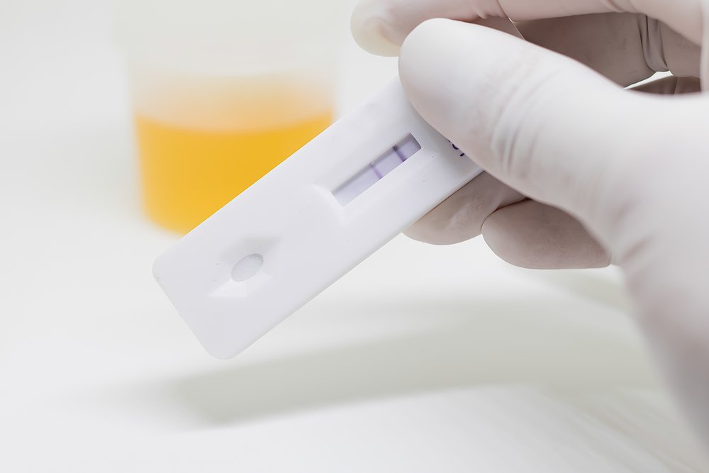 Медицинские тесты. Urine Test.